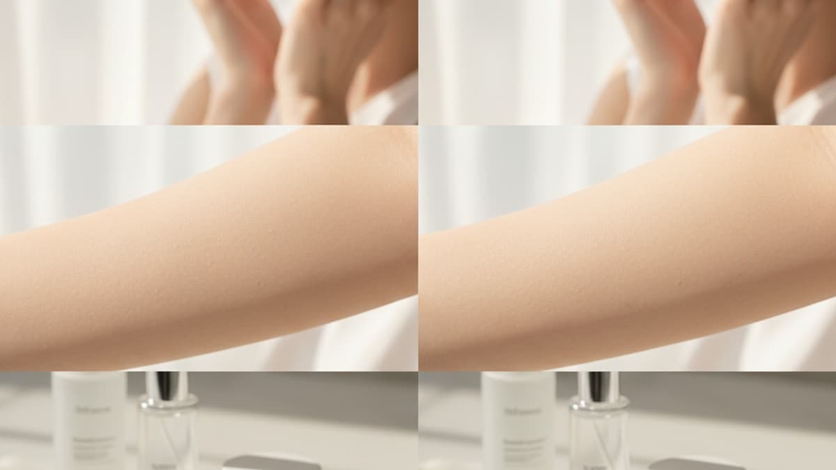 Glutathione Injections: How Effective Are They, Really?